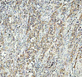 IHC testing of FFPE human testis tissue with GSTM3 antibody at 1ug/ml. Required HIER: steam section in pH6 citrate buffer for 20 min and allow to cool prior to testing.