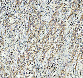 IHC testing of FFPE human testis tissue with GSTM3 antibody at 1ug/ml. Required HIER: steam section in pH6 citrate buffer for 20 min and allow to cool prior to testing.
