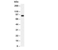 Western blot testing of CSF3R antibody and human placenta tissue lysate