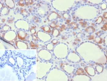 IHC staining of FFPE human thyroid tissue with HEG1 antibody (clone HEG1/9445). Inset: PBS used in place of primary Ab (secondary Ab negative control). HIER: boil tissue sections in pH 9 10mM Tris with 1mM EDTA for 20 min and allow to cool before testing.