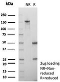 SDS-PAGE analysis of purified, BSA-free Alpha-2M antibody (clone A2M/6556) as confirmation of integrity and purity.