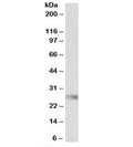 Western blot testing of human bone marrow lysate with HLA-DQA2 antibody at 0.3ug/ml. Predicted molecular weight: ~28kDa.