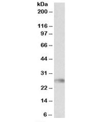 Western blot testing of human bone marrow lysate with HLA-DQA2 antibody at 0.3ug/ml. Predicted molecular weight: ~28kDa.