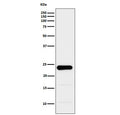 Western blot testing of human PC-3 cell lysate with GSTP1 antibody. Predicted molecular weight ~23 kDa.