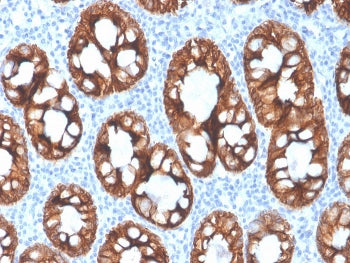 IHC staining of FFPE human colon with recombinant Cytokeratin 8 antibody (clone rKRT8/4209). HIER: boil tissue sections in pH 9 10mM Tris with 1mM EDTA for 20 min and allow to cool before testing.