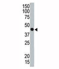 Western blot testing of TSG101 antibody and ZR75-1 cell lysate. Predicted molecular weight ~45 kDa.