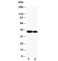 Western blot testing of Connexin 40 antibody different lots of mouse heart tissue lysate. Predicted molecular weight ~40 kDa.