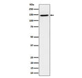 Western blot analysis of TAF3 expression in human HeLa cell lysate using TAF2 antibody. TAF3 antibody detects a strong band at ~140-150 kDa. Although the theoretical mass is ~104 kDa, TAF3 (a TFIID subunit with long acidic/disordered regions) migrates markedly slower on SDS-PAGE, and phosphorylation further increases apparent size.