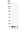Western blot testing of EGF antibody and Lane 1: recombinant mouse partial protein 10ng; 2: 5ng; 3: 2.5ng