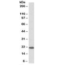 Western blot testing of human cerebellum lysate with Dnajc5 antibody at 0.1ug/ml. Predicted molecular weight: 22 kDa.