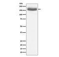 Western blot testing of human urine protein lysate with EGF antibody. Predicted molecular weight: ~134 kDa but routinely observed at 134-160 kDa.