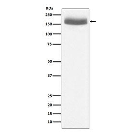 Western blot testing of human urine protein lysate with EGF antibody. Predicted molecular weight: ~134 kDa but routinely observed at 134-160 kDa.