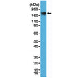 Western blot testing of human MCF7 cell lysate with recombinant CEA antibody at 1:000. Expected molecular weight: 80~200 kDa depending on glycosylation level.