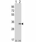 Western blot analysis of IL-33 antibody and 293 cell lysate (2 ug/lane) either nontransfected (Lane 1) or transiently transfected (2) with the IL33 gene. Predicted molecular weight: ~31/26kDa (isoforms a/b).