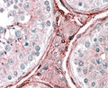 IHC testing of FFPE human testis with CYBRD1 antibody at 2.5ug/ml. HIER: steamed with pH6 citrate buffer, AP-staining.