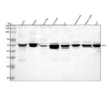 Western blot analysis of IRX1 using anti-IRX1 antibody. Lane 1: human U251 whole cell lysates, Lane 2: human Hacat whole cell lysates, Lane 3: rat lung tissue lysates, Lane 4: rat brain tissue lysates, Lane 5: rat C6 whole cell lysates, Lane 6: mouse lung tissue lysates, Lane 7: mouse brain tissue lysates, Lane 8: mouse LLC tissue lysates. After electrophoresis, proteins were transferred to a nitrocellulose membrane at 150 mA for 50-90 min. Blocked the membrane with 5% non-fat milk/TBS for 1.5 hour at RT.