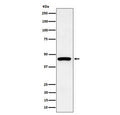 Western blot testing of human HepG2 cell lysate with Keratin 19 antibody. Predicted molecular weight ~43 kDa.