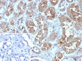 IHC staining of FFPE human kidney tissue with FABP1 antibody (clone FABP1/4462). HIER: boil tissue sections in pH 9 10mM Tris with 1mM EDTA for 20 min and allow to cool before testing.