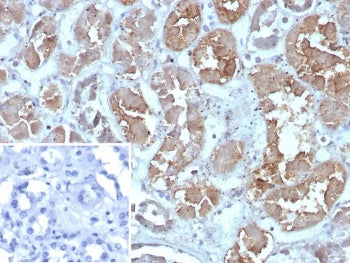 IHC staining of FFPE human kidney tissue with FABP1 antibody (clone FABP1/4462). HIER: boil tissue sections in pH 9 10mM Tris with 1mM EDTA for 20 min and allow to cool before testing.