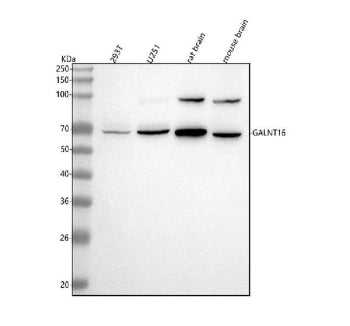 Western blot analysis of GALNT16 using anti-GALNT16 antibody. Lane 1: human 293T whole cell lysates, Lane 2: human U251 whole cell lysates, Lane 3: rat brain tissue lysates, Lane 4: mouse brain tissue lysates. After electrophoresis, proteins were transferred to a nitrocellulose membrane at 150 mA for 50-90 min. Blocked the membrane with 5% non-fat milk/TBS for 1.5 hour at RT.