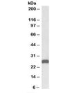 Western blot testing of mouse liver lysate with ETFB antibody at 0.01ug/ml. Predicted molecular weight: ~28kDa.