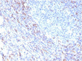 IHC staining of FFPE human tonsil with recombinant ZAP70 antibody. HIER: boil tissue sections in pH 9 10mM Tris with 1mM EDTA for 20 min and allow to cool before testing.
