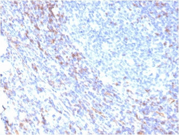 IHC staining of FFPE human tonsil with recombinant ZAP70 antibody. HIER: boil tissue sections in pH 9 10mM Tris with 1mM EDTA for 20 min and allow to cool before testing.