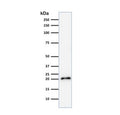 Western blot testing of human HeLa cell lysate with recombinant CDNK1A antibody (clone CIP1/2275R).