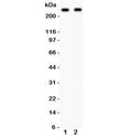Western blot testing of CaV1.3 antibody and Lane 1: rat brain; 2: mouse brain lysate. Predicted molecular weight: ~245 kDa.