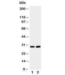 Western blot testing of Prion protein antibody and Lane 1: rat brain; 2: rat brain. Expected molecular weight: 20~29kDa.