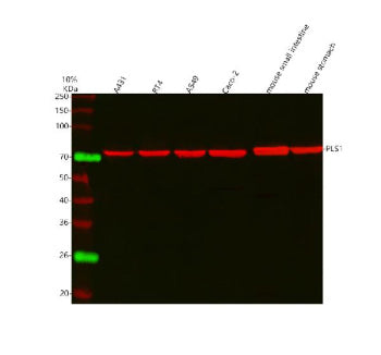 Western blot analysis of PLS1 using anti-PLS1 antibody. Lane 1: human whole cell lysates, Lane 2: human RT4 whole cell lysates, Lane 3: human whole cell lysates, Lane 4: human Caco-2 whole cell lysates, Lane 5: rat small intestine tissue lysates, Lane 6: rat stomach tissue lysates, Lane 7: mouse small intestine tissue lysates, Lane 8: mouse stomach tissue lysates. After electrophoresis, proteins were transferred to a nitrocellulose membrane at 150 mA for 50-90 min.