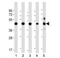 Western blot testing of NSFL1C antibody at 1:2000 + human lysate 1: 293, 2: A431, 3: NCI-H1299, 4: U-251 MG, and 5: mouse brain lysate. Predicted molecular weight ~41 kDa.