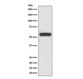 Western blot testing of rat brain lysate with Aromatase antibody. Predicted molecular weight ~58 kDa.