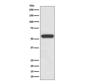 Western blot testing of rat brain lysate with Aromatase antibody. Predicted molecular weight ~58 kDa.