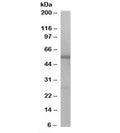 Western blot testing of Jurkat lysate with DBNL antibody at 1ug/ml. Predicted molecular weight: ~49kDa.