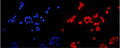 Immunofluorescent staining of FFPE human MCF7 cells with ETS Variant 5 antibody (red) and DAPI nuclear stain (blue). HIER: steam section in pH6 citrate buffer for 20 min.