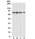 Western blot of mouse NIH3T3 (A), and human HeLa (B), Jurkat (C), and A431 (D) lysates with Radixin antibody at 0.01ug/ml. Predicted molecular weight: ~69kDa, routinely observed at ~82kDa (Ref 1).