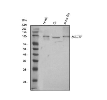 Western blot analysis of MELTF using anti-MELTF antibody. Lane 1: human whole cell lysates, Lane 2: human whole cell lysates, Lane 3: human whole cell lysates, Lane 4: human PC-3 whole cell lysates. After electrophoresis, proteins were transferred to a nitrocellulose membrane at 150 mA for 50-90 min. Blocked the membrane with 5% non-fat milk/TBS for 1.5 hour at RT.
