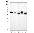Western blot testing of 1) rat brain, 2) rat C6, 3) mouse lung, 4) mouse brain and 5) mouse NIH 3T3 cell lysate with Interferon regulatory factor 3 antibody. Predicted molecular weight ~47 kDa.