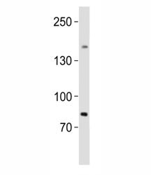 Western blot analysis of lysate from human testis tissue lysate using SALL4 antibody diluted at 1:1000. Predicted molecular weight of isoforms A: 112~165 kDa and B: 65~95 kDa.