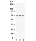 Western blot testing of 1) mouse pancreas, 2) human Jurkat and 3) human HepG2 lysate with SPP1 antibody. Expected/observed molecular weight: 35/60-65 kDa (unmodified/glycosylated).