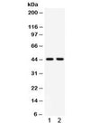 Western blot testing of human 1) placenta and 2) HepG2 lysate with WNT3 antibody. Expected/observed size 35~44 kDa depending on glycosylation level.