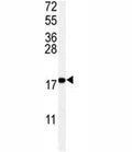 Western blot analysis of UBC9 antibody and Ramos lysate