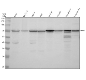 Western blot analysis of HBP1 using anti-HBP1 antibody. Electrophoresis was performed on a 10% SDS-PAGE gel at 80V (Stacking gel) / 120V (Resolving gel) for 2 hours. Lane 1: human K562 whole cell lysates, Lane 2: human SH-SY5Y whole cell lysates, Lane 3: human MCF-7 whole cell lysates, Lane 4: human SIHA whole cell lysates, Lane 5: rat liver tissue lysates, Lane 6: rat brain tissue lysates, Lane 7: mouse liver tissue lysates, Lane 8: mouse brain tissue lysates.