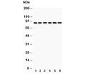 Western blot testing of TLR1 antibody and Lane 1: COLO320; 2: SW620; 3: SKOV; 4: Jurkat; 5: CEM; 6: PANC lysate. Predicted molecular weight ~90 kDa.