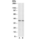 Western blot testing of human heart [A] and lung [B] lysates with KLF2 antibody at 1ug/ml. Predicted molecular weight ~37kDa.
