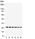 Western blot testing of SNAP23 antibody and Lane 1: rat spleen; 2: (r) testis; 3: (r) ovary; 4: human HeLa; 5: (h) MCF-7; 6: (h) SKOV; Expected molecular weight: ~23/18kDa (isoforms 1/2).
