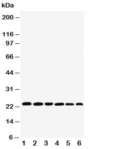 Western blot testing of SNAP23 antibody and Lane 1: rat spleen; 2: (r) testis; 3: (r) ovary; 4: human HeLa; 5: (h) MCF-7; 6: (h) SKOV; Expected molecular weight: ~23/18kDa (isoforms 1/2).