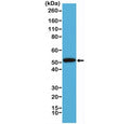 Western blot testing of human A431 cell lysate with recombinant Cytokeratin 14 antibody at 1:1000. Predicted molecular weight ~53 kDa.