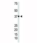 IKBa antibody used in western blot to detect IKB-alpha in Jurkat cell lysate